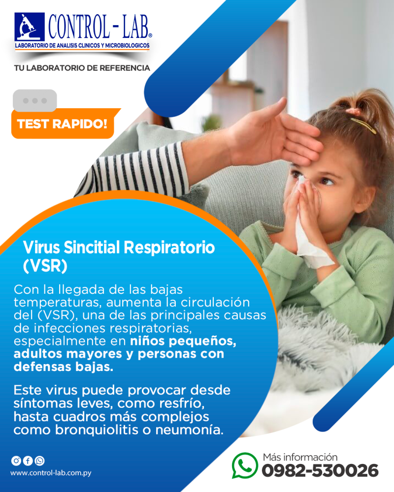 VIRUS SINCITIAL RESPIRATORIO