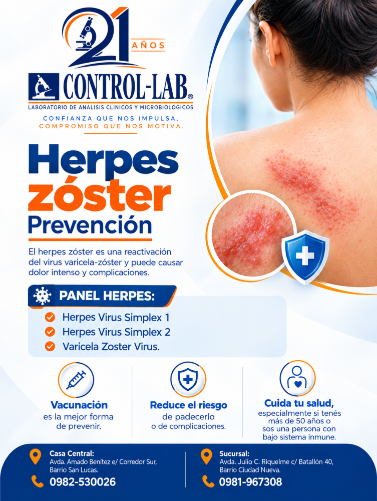 HERPES ZÓSTER: `REVENCIÓN